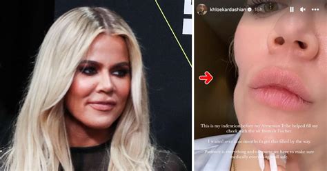 khloe kardashian cancer on face